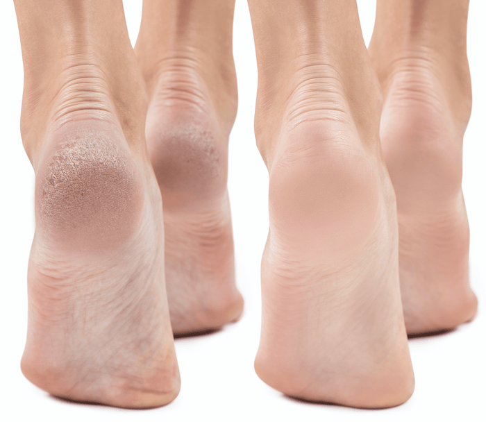 MIRENESSE MASK 1 Active Foot Renew Treatment Booties With 15 Golden Oils + Retinol