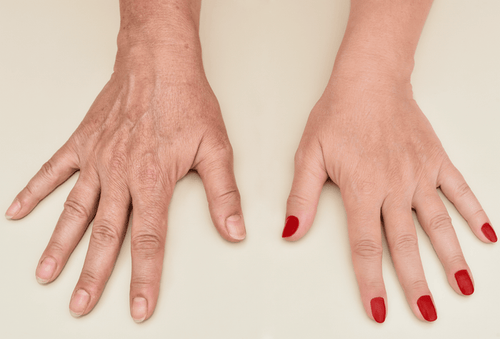 MIRENESSE MASK 1 Active Hand Renew Treatment Gloves With 15 Golden Oils+ Antiageing Retinol