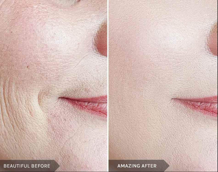 MIRENESSE SKINCARE 15g / 0.53oz Endless Youth Instant Filler- Limited Stock