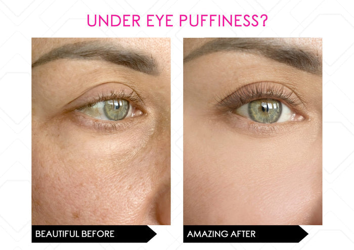 MIRENESSE SKINCARE i-Spresso Vibraserum (Eye Serum) Dark Circles & Puffiness- Vibrating Cooling Applicator 15g