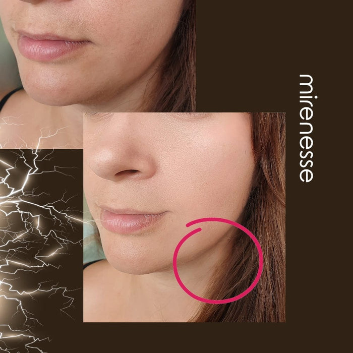 Mirenesse Skincare Power Lift Face Fitness 8 In 1 Microcurrent| Ems Device
