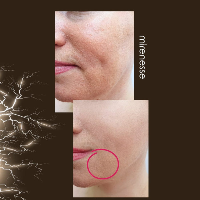 Mirenesse Skincare Power Lift Face Fitness 8 In 1 Microcurrent| Ems Device