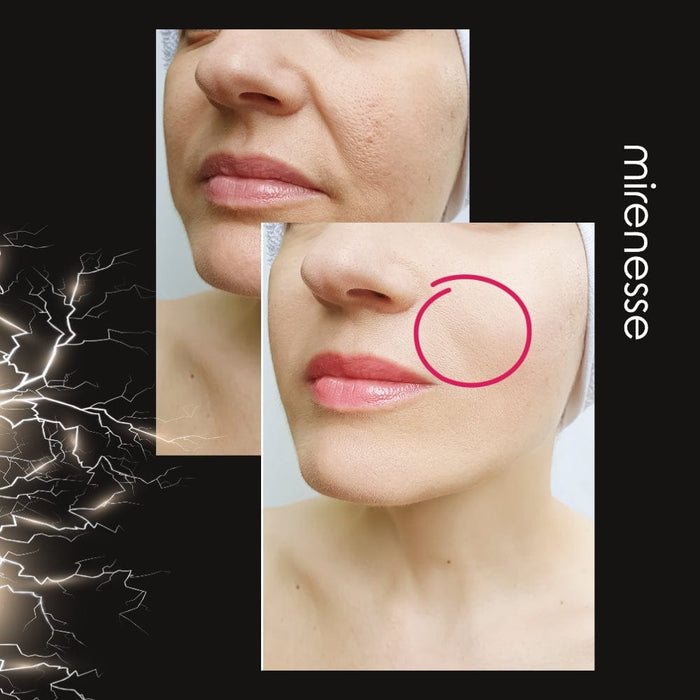 Mirenesse Skincare Power Lift Face Fitness 8 In 1 Microcurrent| Ems Device