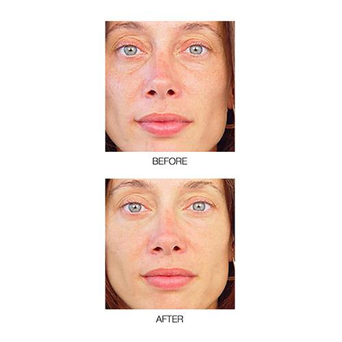 MIRENESSE PACK SKIN Power Lift Moisturise, Hydrate & Protect 3pce Kit
