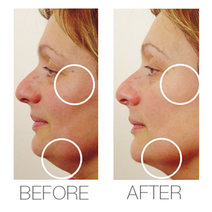 MIRENESSE PACK SKIN Power Lift + Sculpt Collagen Smooth + Boost Tired Skin 4pce