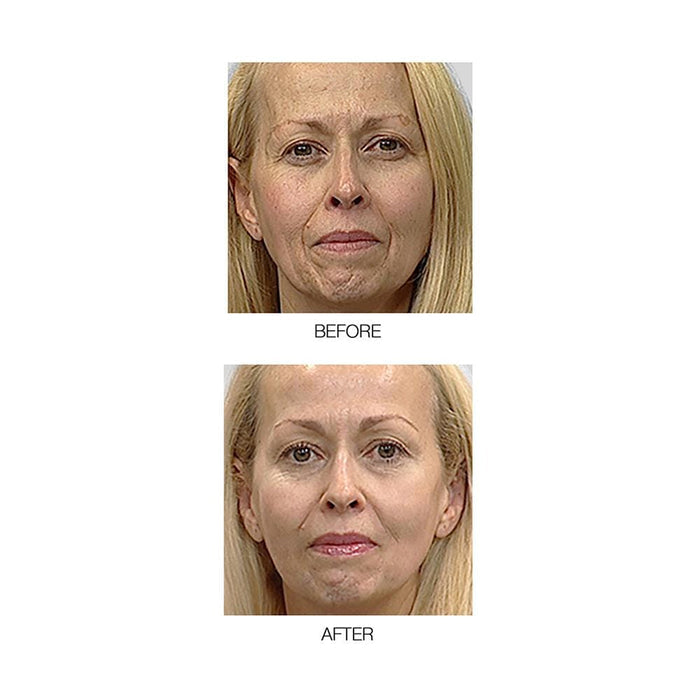 MIRENESSE PACK SKIN Power Lift + Sculpt Collagen Smooth + Boost Tired Skin 4pce