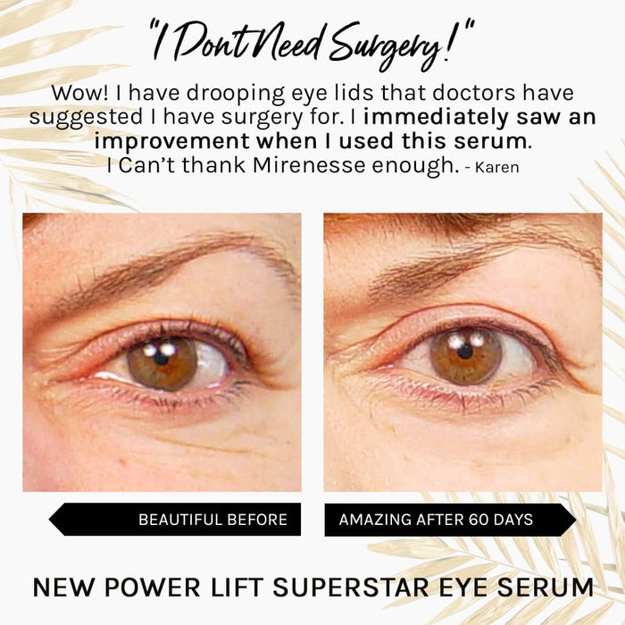 MIRENESSE ANTIAGEING 15g / 0.53oz Winner Best Eye Serum - Superstar Eye Serum with Retinal