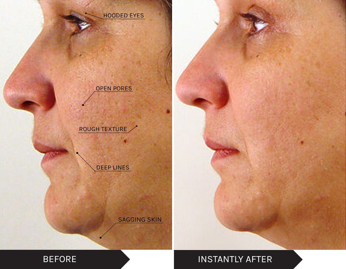 Mirenesse ANTIAGEING Power Lift Treatment Cream Moisturiser + Free Mini (15g)