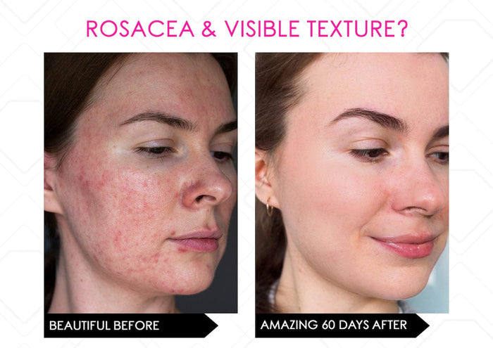Mirenesse TOOLS & ACCESSORIES Skin Secrets Amazing Multi Light Therapy + Infrared Ir288 Led Mask FDA Cleared