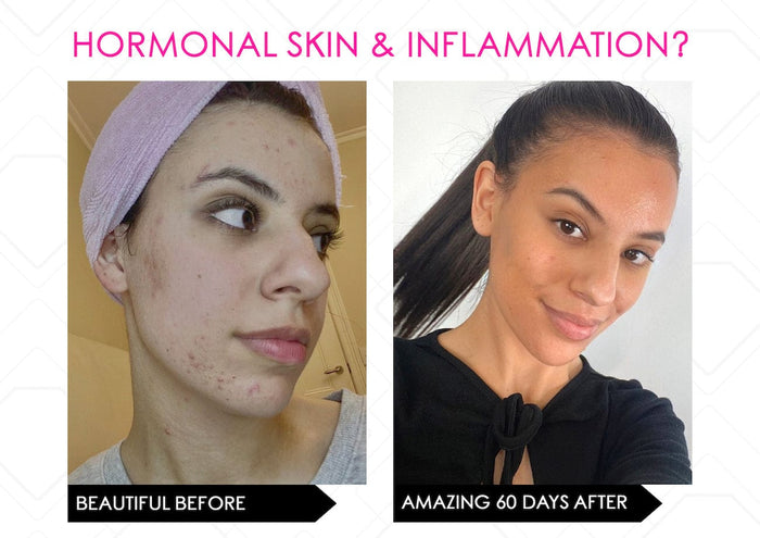 Mirenesse TOOLS & ACCESSORIES Skin Secrets Amazing Multi Light Therapy + Infrared Ir288 Led Mask FDA Cleared