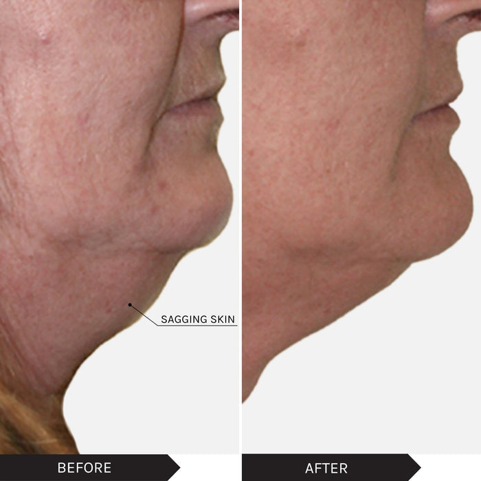 MIRENESSE PACK MS Velvet Maxisculpt V Shape Collagen Gel + Free Mini