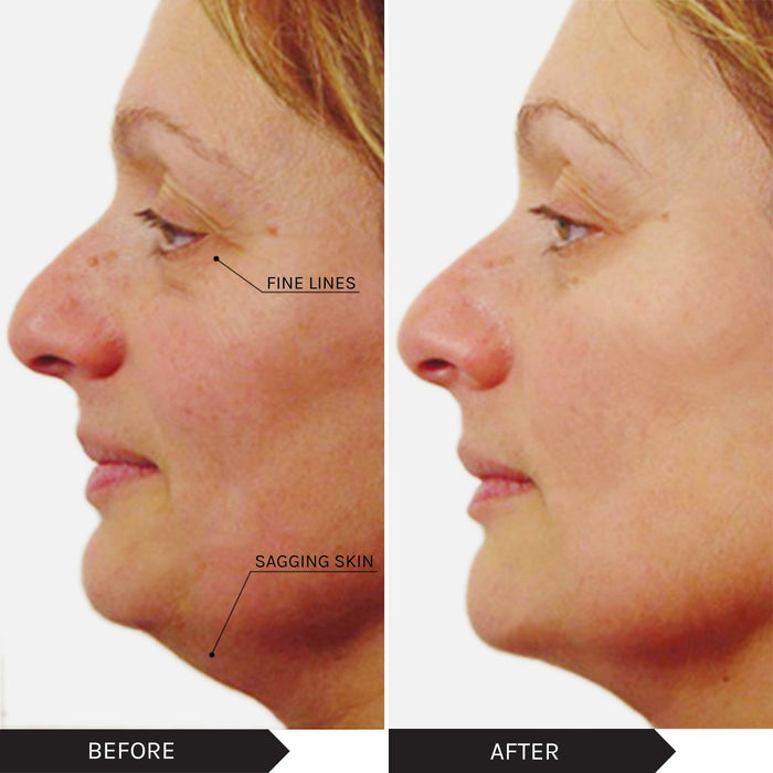 MIRENESSE PACK MS Velvet Maxisculpt V Shape Collagen Gel + Free Mini
